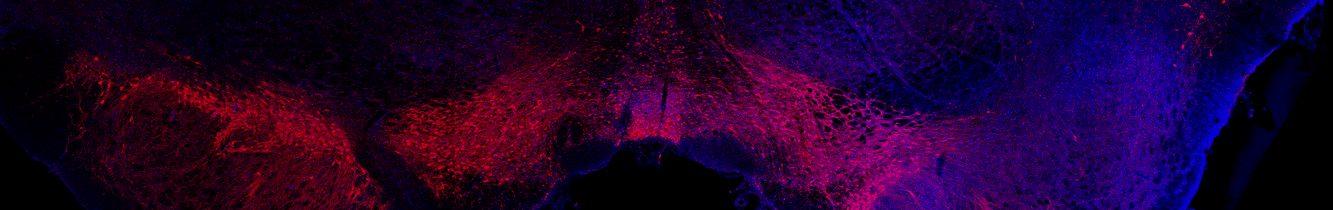 Dopaminergic neuron preservation in SNpc